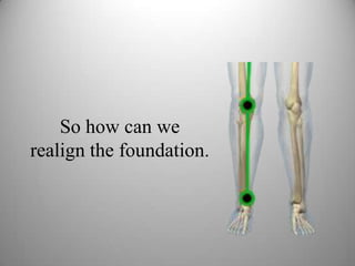 So how can we
realign the foundation.
 