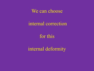 We can choose
internal correction
for this
internal deformity
 