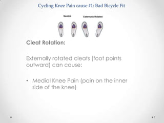 Cycling Knee Pain cause #1: Bad Bicycle Fit




Cleat Rotation:

Externally rotated cleats (foot points
outward) can cause:

• Medial Knee Pain (pain on the inner
  side of the knee)




                                                  7
 