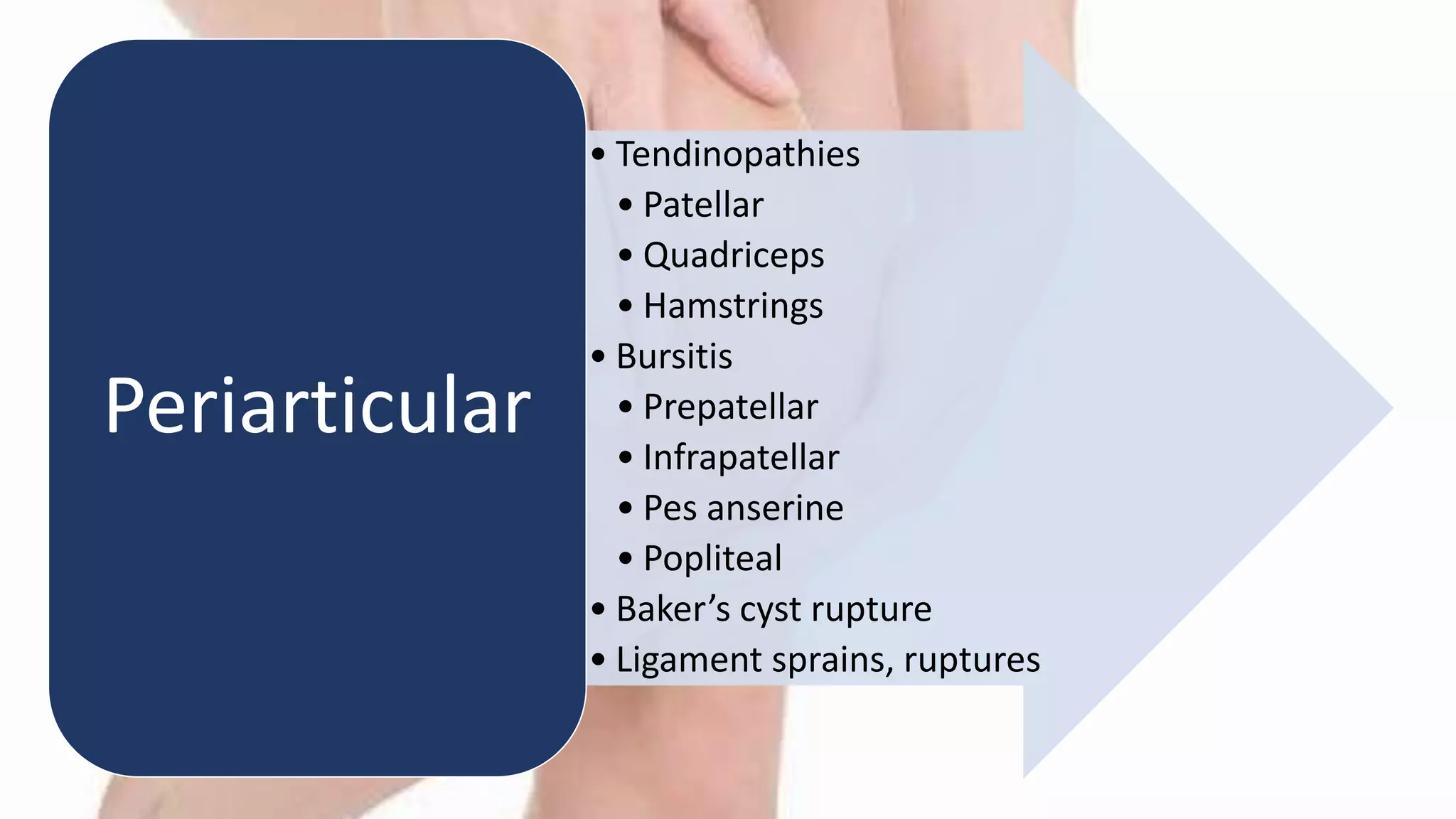 Differential Diagnosis of Knee Pain | PPTX