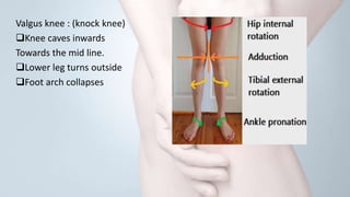 Knee pain | PPTX