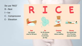 Knee Rice Principle Knee pain | PPTX