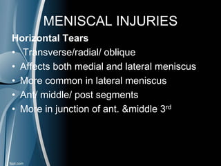 MENISCAL INJURIES
Horizontal Tears
• Transverse/radial/ oblique
• Affects both medial and lateral meniscus
• More common in lateral meniscus
• Ant/ middle/ post segments
• More in junction of ant. &middle 3rd
 