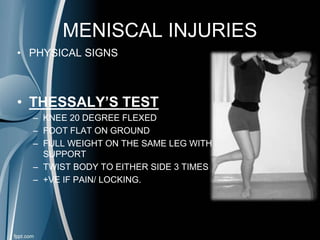 MENISCAL INJURIES
• PHYSICAL SIGNS
• THESSALY’S TEST
– KNEE 20 DEGREE FLEXED
– FOOT FLAT ON GROUND
– FULL WEIGHT ON THE SAME LEG WITH
SUPPORT
– TWIST BODY TO EITHER SIDE 3 TIMES
– +VE IF PAIN/ LOCKING.
 