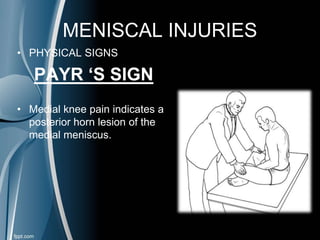 MENISCAL INJURIES
• PHYSICAL SIGNS
PAYR ‘S SIGN
• Medial knee pain indicates a
posterior horn lesion of the
medial meniscus.
 