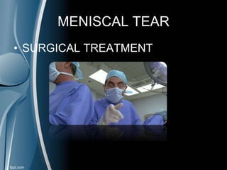 MENISCAL TEAR
• SURGICAL TREATMENT
 