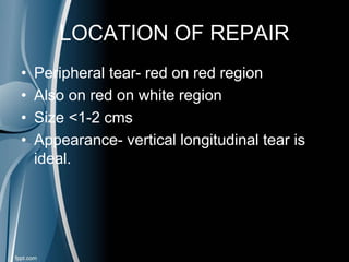 LOCATION OF REPAIR
• Peripheral tear- red on red region
• Also on red on white region
• Size <1-2 cms
• Appearance- vertical longitudinal tear is
ideal.
 