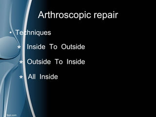 Arthroscopic repair
• Techniques
* Inside To Outside
* Outside To Inside
* All Inside
 