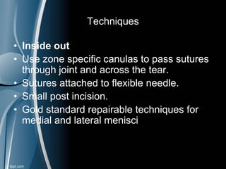 Techniques
• Inside out
• Use zone specific canulas to pass sutures
through joint and across the tear.
• Sutures attached to flexible needle.
• Small post incision.
• Gold standard repairable techniques for
medial and lateral menisci
 