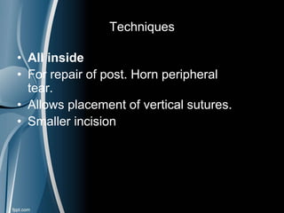 Techniques
• All inside
• For repair of post. Horn peripheral
tear.
• Allows placement of vertical sutures.
• Smaller incision
 