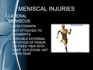 MENISCAL INJURIES
• LATERAL
MENISCUS
– LESS COMMON
– NOT ATTACHED TO
LIGAMENTS
– FORCIBLE EXTERNAL
ROTATION OF FEMUR
ON FIXED TIBIA WITH
KNEE IN FLEXION- ANT.
HORN TEAR
 