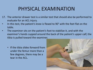 PHYSICAL EXAMINATION
• If the tibia slides forward from
under the femur more than a
few degrees, there may be a
tear in the ACL.
17. The anterior drawer test is a similar test that should also be performed to
evaluate for an ACL injury.
• In this test, the patient’s knee is flexed to 90° with the feet flat on the
table.
• The examiner sits on the patient’s foot to stabilize it, and with the
examiner’s hands cupped around the back of the patient’s upper calf, the
tibia is pulled toward the examiner.
 