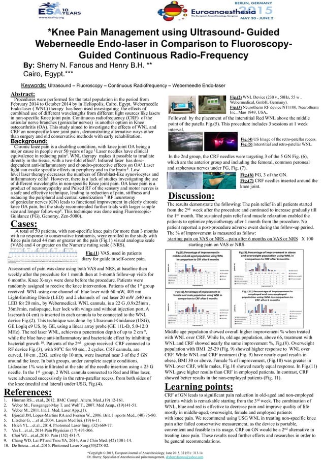 Knee Pain Management using Ultrasound Guided erneedle Endolaser in