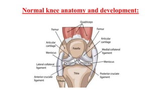 Normal Knee Development knee popping in newborn and childern.pptx