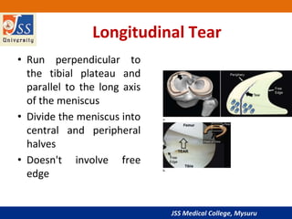 MRI KNEE.pptx