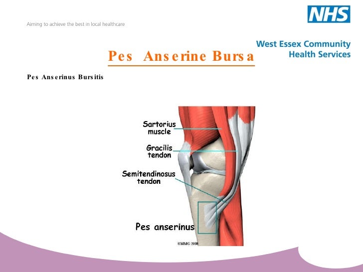 knee_pres_1[1]