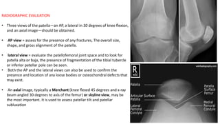 BIOMECHANICS & PATHOMECHANICS OF KNEE JOINT AND PATELLOFEMORAL JOINT | PPTX
