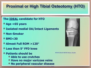POSTGRAD ORTH Deiary Kader
Proximal or High Tibial Osteotomy (HTO) 
The IDEAL candidate for HTO
Age <65 years
Isolated med...
