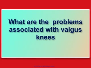 POSTGRAD ORTH Deiary Kader
What are the problems
associated with valgus
knees
 