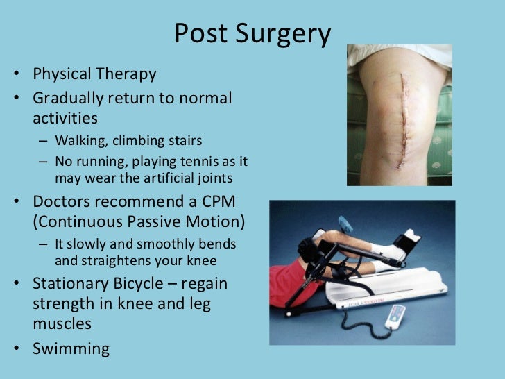 Knee Replacement Desun Hospital Health Insight