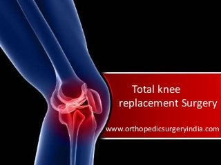 Total knee
replacement Surgery
www.orthopedicsurgeryindia.com
 
