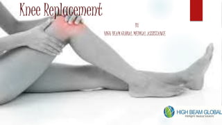 BY
HIGH BEAM GLOBAL MEDICAL ASSISTANCE
Knee Replacement
 