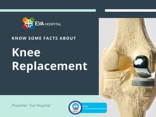 KNOW SOME FACTS ABOUT
Knee
Replacement
Presenter: Eva Hospital
 