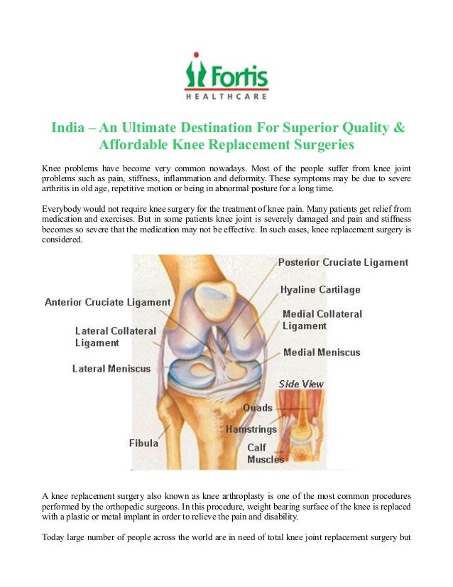 Knee Replacement Surgery Cost