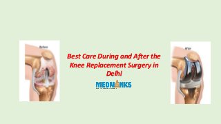 Best Care During and After the
Knee Replacement Surgery in
Delhi
 