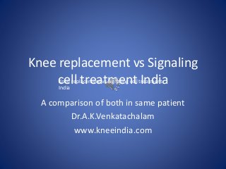 Knee replacement vs Signaling
cell treatment India
A comparison of both in same patient
Dr.A.K.Venkatachalam
www.kneeindia.com
Knee replacement vs Signaling cell treatment
India
 