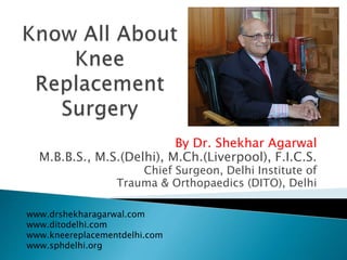 By Dr. Shekhar Agarwal
M.B.B.S., M.S.(Delhi), M.Ch.(Liverpool), F.I.C.S.
Chief Surgeon, Delhi Institute of
Trauma & Orthopaedics (DITO), Delhi
www.drshekharagarwal.com
www.ditodelhi.com
www.kneereplacementdelhi.com
www.sphdelhi.org
 