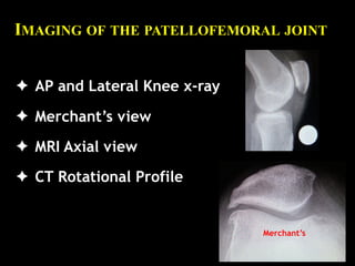  
ROTATIONAL PROFILE CT 
EVIDENCE BASED INTERVENTION
1. Femoral Anteversion N=50 -150
2. Knee rotation N=30
3. External Ti...