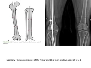 Knee joint xray views | PPTX