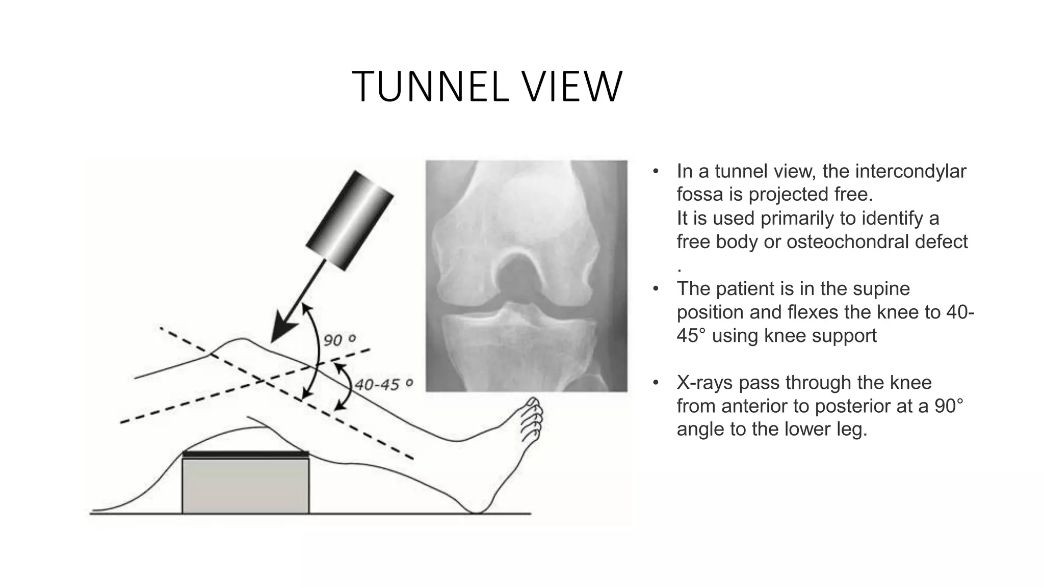 X Ray And MRI Of Knee Joint PPTX x-ray-and-mri-of-knee-joint-pptx