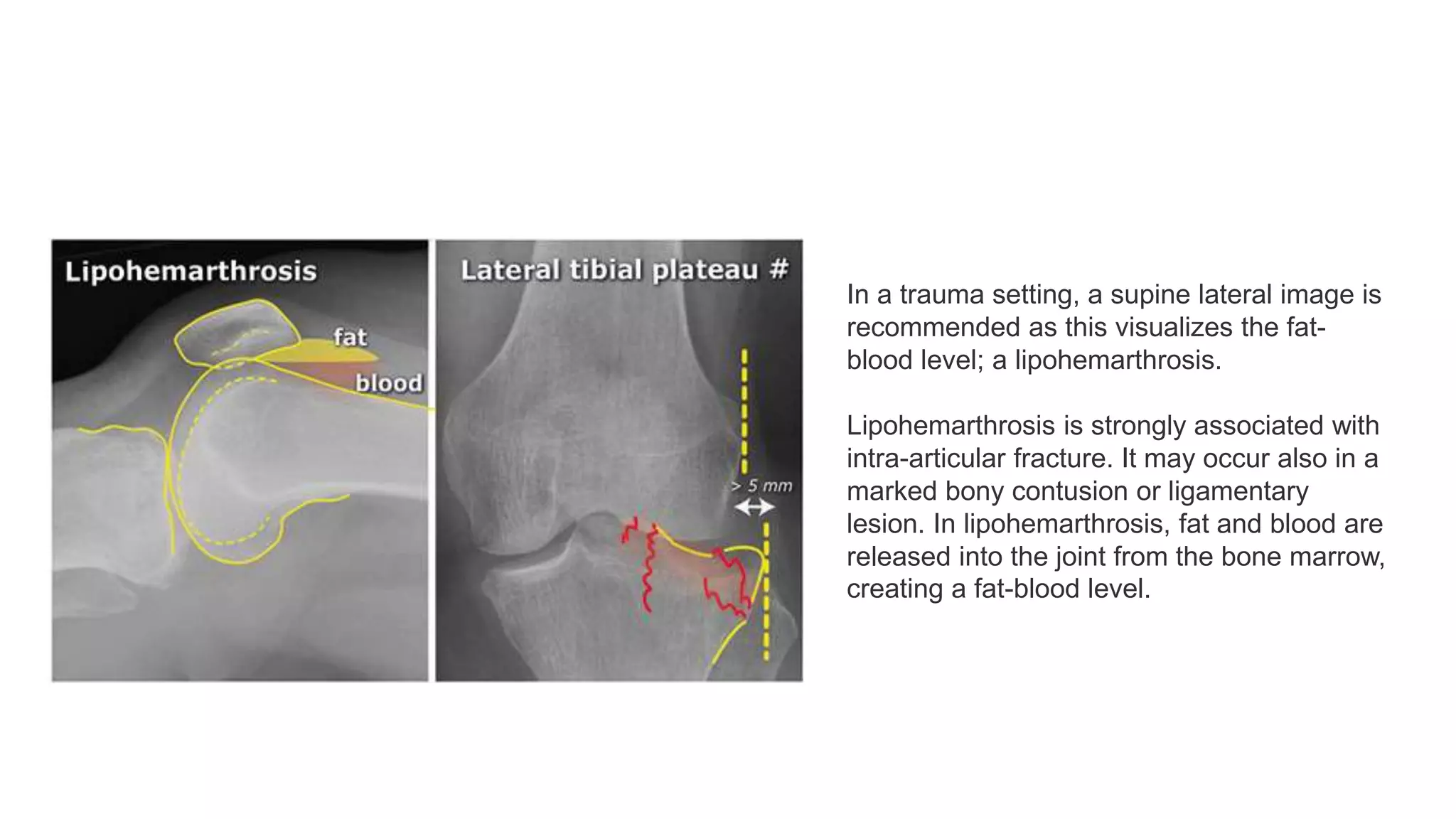 X Ray And MRI Of Knee Joint PPTX x-ray-and-mri-of-knee-joint-pptx