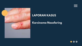 Karsinoma Nasofaring
LAPORAN KASUS
 