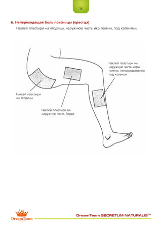 14
DreamTeam SECRETUM NATURALIS™
6. Непереходящая боль поясницы (крестца)
Наклей пластыри на ягодицы, наружнюю часть икр голени, под коленями.
Наклей пластыри
на ягодицы
Наклей пластыри на
наружную часть бедра
Наклей пластыри на
наружную часть икры
голени, непосредственно
под коленом
 