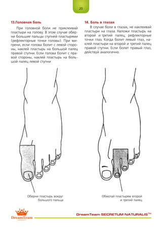 20
DreamTeam SECRETUM NATURALIS™
13.Головная боль
При головной боли не приклеивай
пластыри на голову. В этом случае обер-
ни большие пальцы ступней пластырями
(рефлекторные точки головы). При ми-
грени, если голова болит с левой сторо-
ны, наклей пластырь на большой палец
правой ступни. Если голова болит с пра-
вой стороны, наклей пластырь на боль-
шой палец левой ступни
14. Боль в глазах
В случае боли в глазах, не наклеивай
пластыри на глаза. Наложи пластырь на
второй и третий палец, рефлекторные
точки глаз. Когда болит левый глаз, на-
клей пластыри на второй и третий палец
правой ступни. Если болит правый глаз,
действуй аналогично.
Оберни пластырь вокруг
большого пальца
Обмотай пластырем второй
и третий палец
 