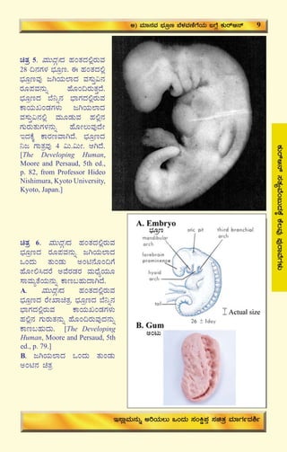 13
PÀÄgïD£ï¸ÀvÀåªÉA§ÄzÀPÉÌPÉ®ªÀÅ¥ÀÅgÁªÉUÀ¼ÀÄ
avÀæ 5. ªÀÄÄzÀÎBzÀ ºÀAvÀzÀ°ègÀÄªÀ
28 ¢£ÀUÀ¼À ¨sÀÆæt. F ºÀAvÀzÀ°è
¨sÀÆætªÀÅ dVAiÀÄ¯ÁzÀ ªÀ¸ÀÄÛ«£À
gÀÆ¥ÀªÀ£ÀÄß ºÉÆA¢gÀÄvÀÛzÉ.
¨sÀÆætzÀ ¨É¤ß£À ¨sÁUÀzÀ°ègÀÄªÀ
PÁAiÀÄRAqÀUÀ¼ÀÄ dVAiÀÄ¯ÁzÀ
ªÀ¸ÀÄÛ«£À°è ªÀÄÆqÀÄªÀ ºÀ°è£À
UÀÄgÀÄvÀÄUÀ¼À£ÀÄß ºÉÆÃ®ÄªÀÅzÉÃ
EzÀPÉÌ PÁgÀtªÁVzÉ. ¨sÀÆætzÀ
¤d UÁvÀæªÀÅ 4 «Ä.«ÄÃ. DVzÉ.
[The Developing Human,
Moore and Persaud, 5th ed.,
p. 82, from Professor Hideo
Nishimura, Kyoto University,
Kyoto, Japan.]
avÀæ 6. ªÀÄÄzÀÎBzÀ ºÀAvÀzÀ°ègÀÄªÀ
¨sÀÆætzÀ gÀÆ¥ÀªÀ£ÀÄß dVAiÀÄ¯ÁzÀ
MAzÀÄ vÀÄAqÀÄ CAn£ÉÆA¢UÉ
ºÉÆÃ°¹zÀgÉ CªÉgÀqÀgÀ ªÀÄzsÉåAiÀÄÆ
¸ÁªÀÄåvÉAiÀÄ£ÀÄß PÁt§ºÀÄzÁVzÉ.
A. ªÀÄÄzÀÎBzÀ ºÀAvÀzÀ°ègÀÄªÀ
¨sÀÆætzÀ gÉÃSÁavÀæ. ¨sÀÆætzÀ ¨É¤ß£À
¨sÁUÀzÀ°ègÀÄªÀ PÁAiÀÄRAqÀUÀ¼ÀÄ
ºÀ°è£À UÀÄgÀÄvÀ£ÀÄß ºÉÆA¢gÀÄªÀÅzÀ£ÀÄß
PÁt§ºÀÄzÀÄ. [The Developing
Human, Moore and Persaud, 5th
ed., p. 79.]
B. dVAiÀÄ¯ÁzÀ MAzÀÄ vÀÄAqÀÄ
CAn£À avÀæ
C) ªÀiÁ£ÀªÀ ¨sÀÆæt ¨É¼ÀªÀtÂUÉAiÀÄ §UÉÎ PÀÄgïD£ï 9
E¸ÁèªÀÄ£ÀÄß CjAiÀÄ®Ä MAzÀÄ ¸ÀAQë¥ÀÛ ¸ÀavÀæ ªÀiÁUÀðzÀ²ð
¨sÀÆæt
CAlÄ
 