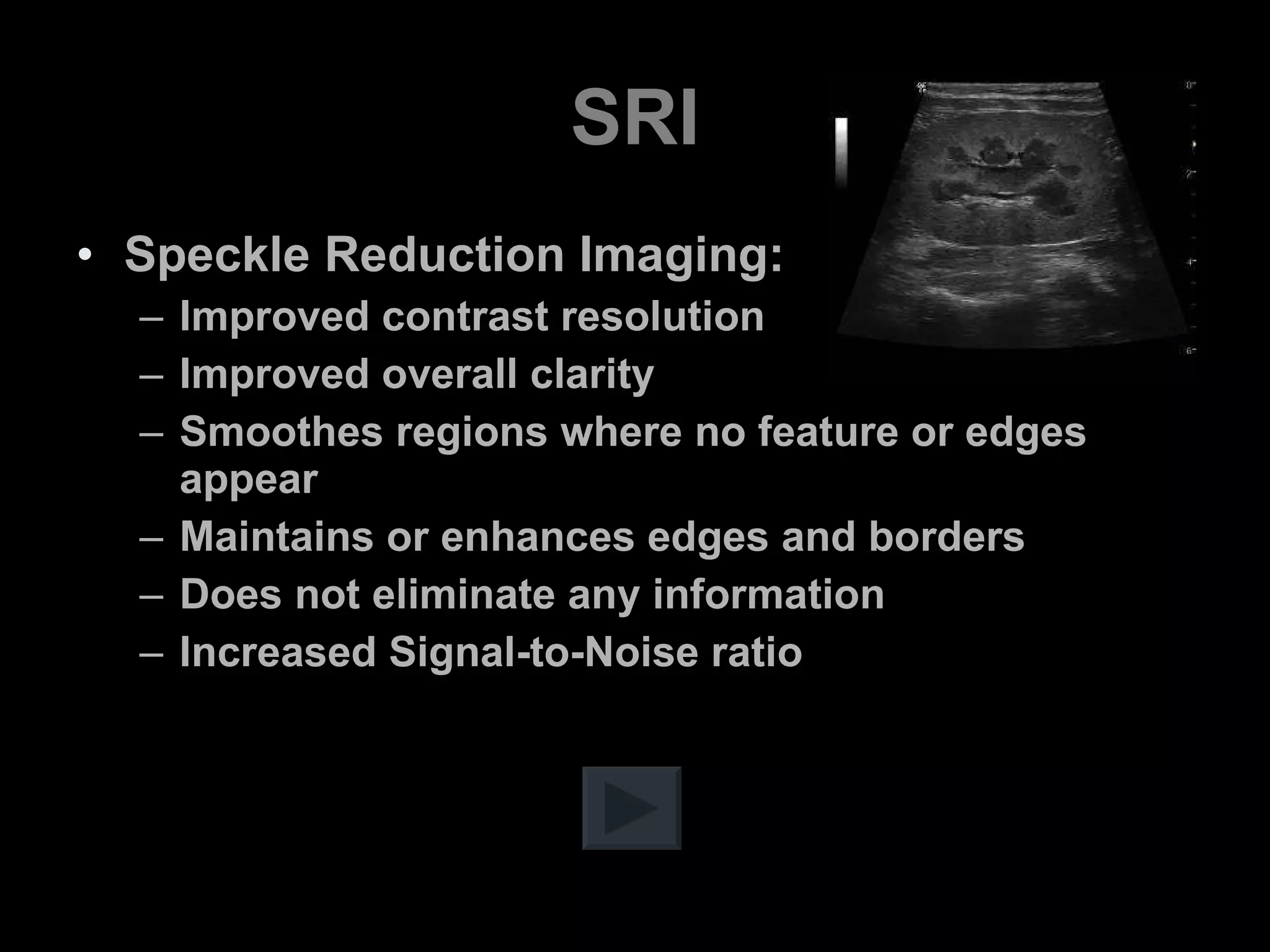 SRI Speckle Reduction Imaging: Improved contrast resolution Improved overall clarity Smoothes regions where no feature or edges appear Maintains or enhances edges and borders Does not eliminate any information Increased Signal-to-Noise ratio 