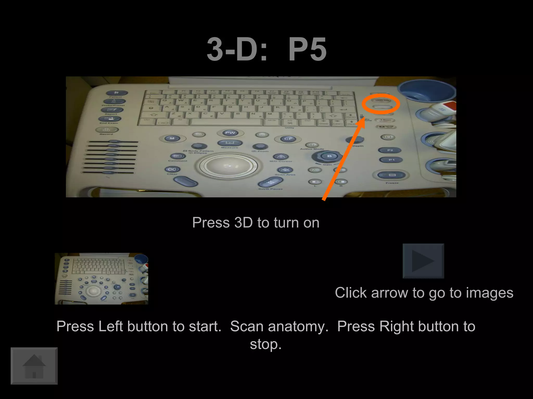 3-D:  P5 Press Left button to start.  Scan anatomy.  Press Right button to stop. Press 3D to turn on Click arrow to go to images 