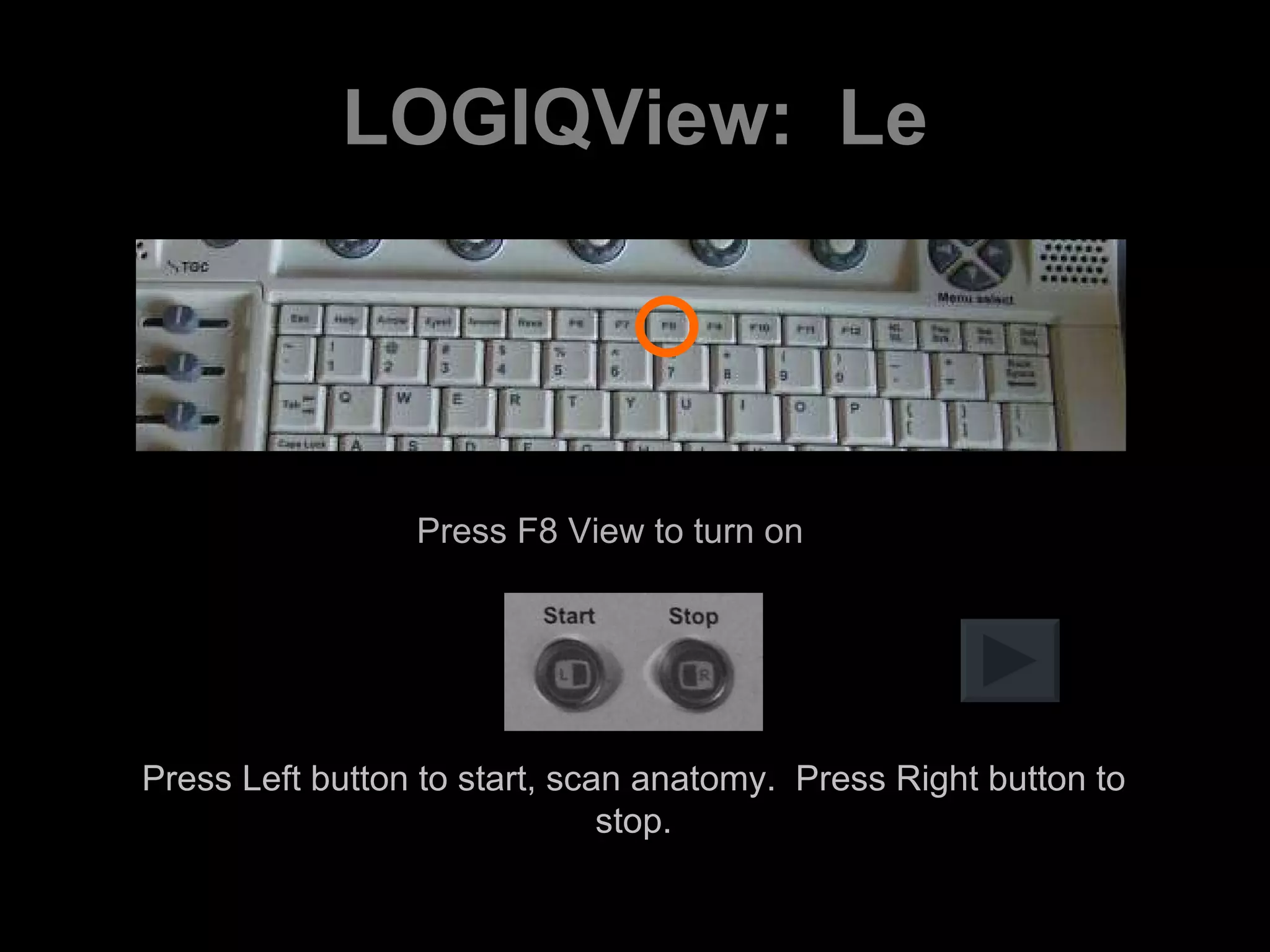 LOGIQView:  Le Press F8 View to turn on Press Left button to start, scan anatomy.  Press Right button to stop. 