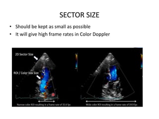 SECTOR SIZE
• Should be kept as small as possible
• It will give high frame rates in Color Doppler
 