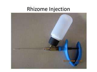 Rhizome Injection
 