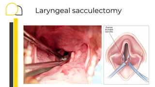 Laryngeal sacculectomy
 