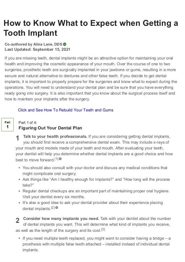 How to know what to expect when getting a tooth implant