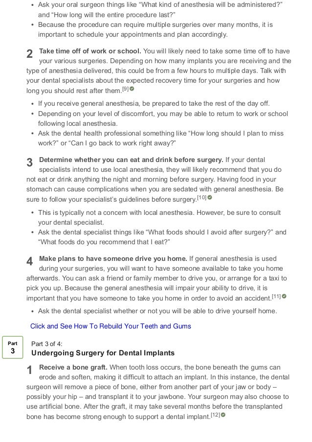 How to know what to expect when getting a tooth implant