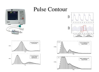 Harris: Cardiac Output in the Resuscitation Room: Have You Considered ...