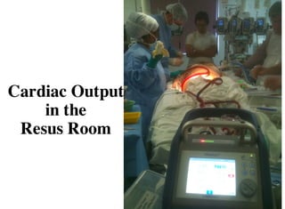 Cardiac Output
in the
Resus Room
 