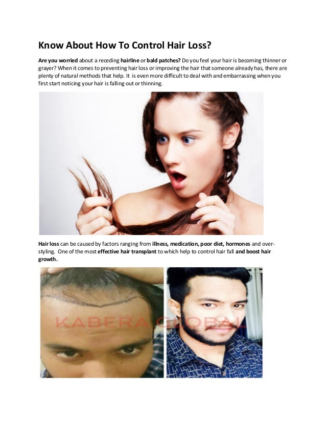 Know About How To Control Hair Loss